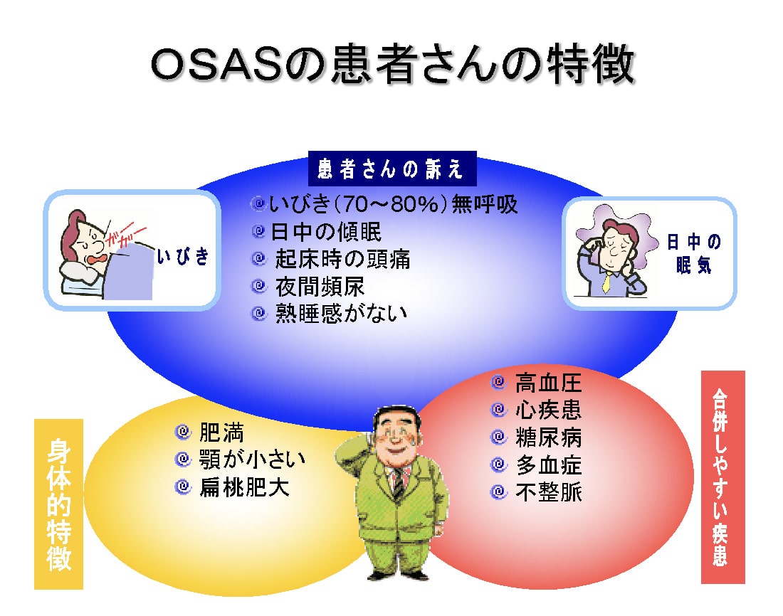 OSAS（閉塞性睡眠時無呼吸症候群）の原因